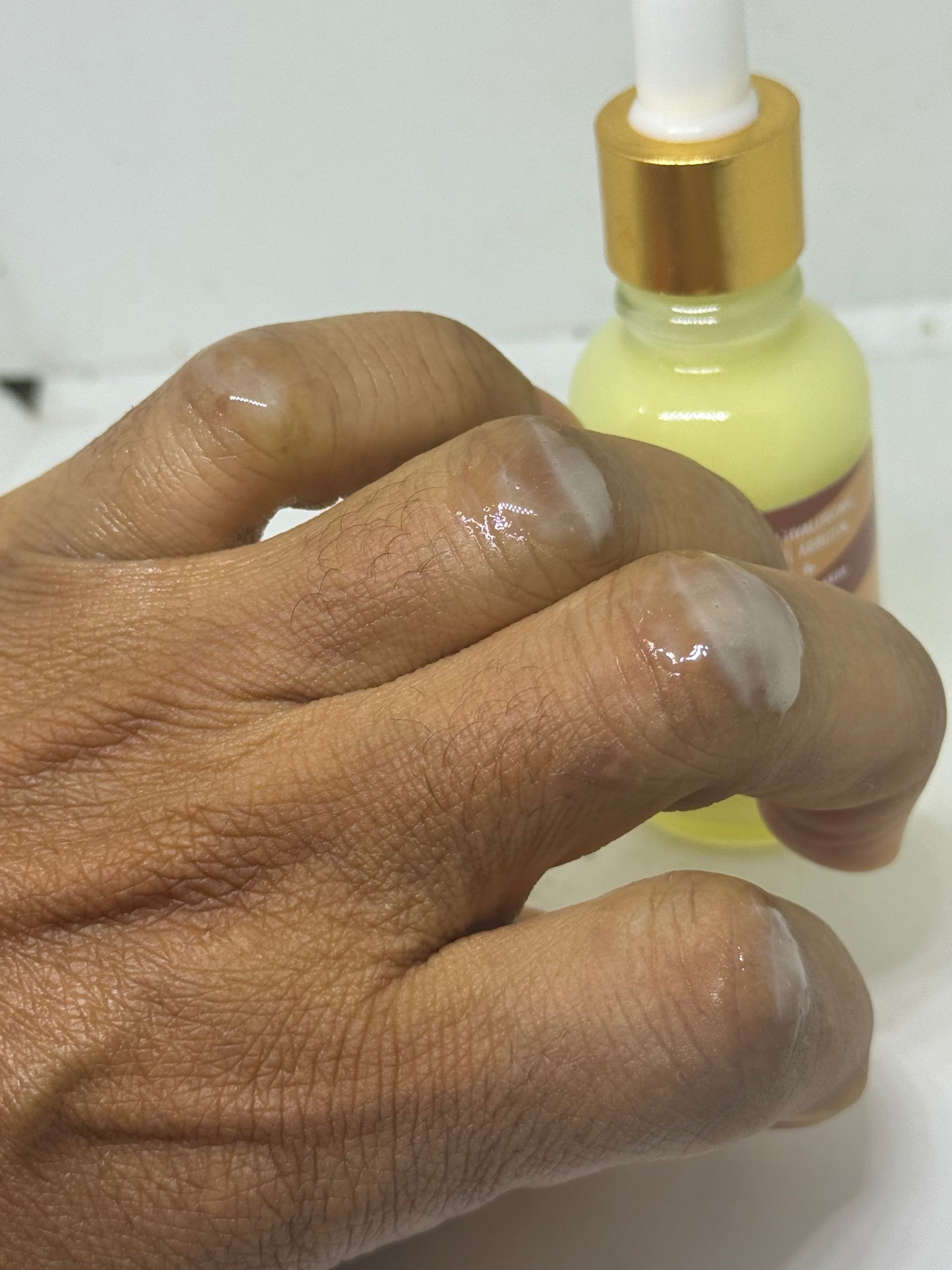 Quick Dark Spot and knuckle solution SERUM 30ML