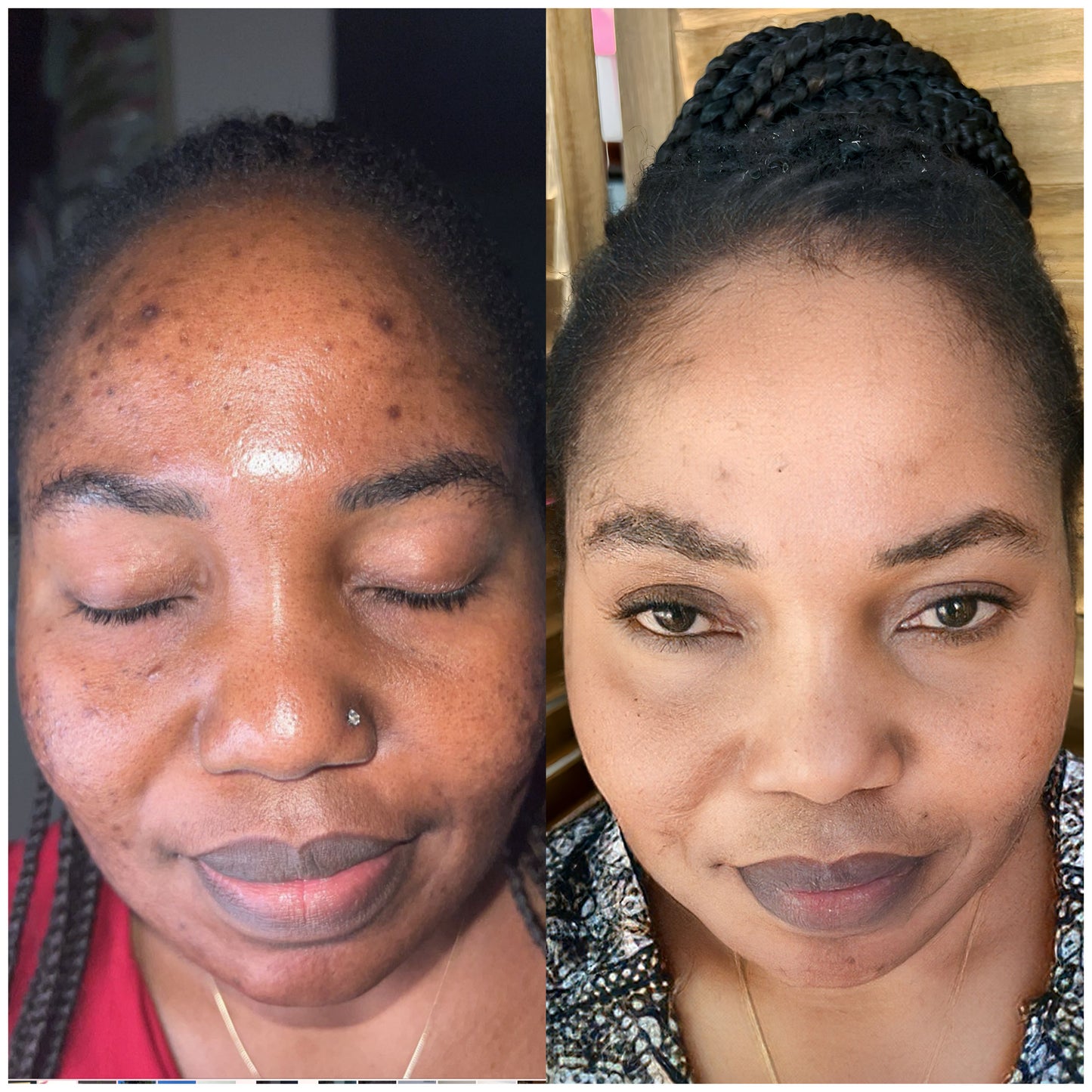 Valentine deal 2 Large Customized cream 2 Face magic + soap and toner