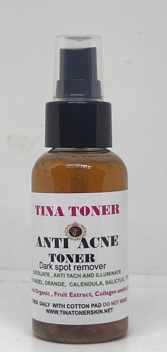 Anti Acne  Regimen with dark spots remover Toner