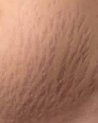 Organic Stretch Marks Cream Botanical Therapy 4 Oz